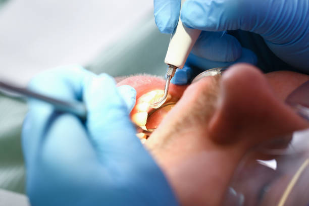 Best Emergency Treatment for Toothache in Shackle Island, TN
