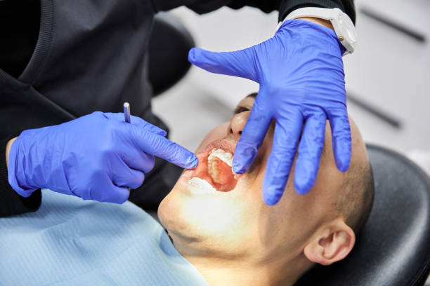 Best Emergency Treatment for Toothache in Shackle Island, TN