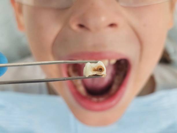 Best Emergency Broken Tooth Repair in Shackle Island, TN